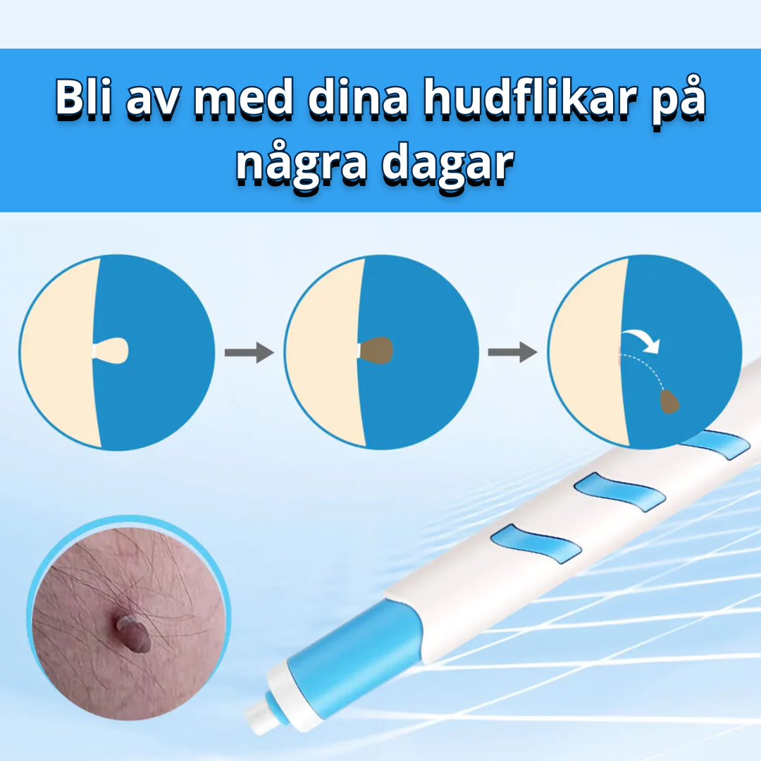 Hudfliksborttagnings Kit